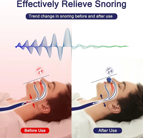 Kompakt Mikro-CPAP i Medisinsk Silikon med USB-Lading til Reise